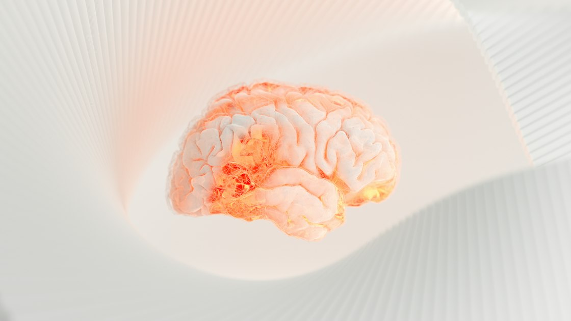 Alzheimer’s Disease Insights